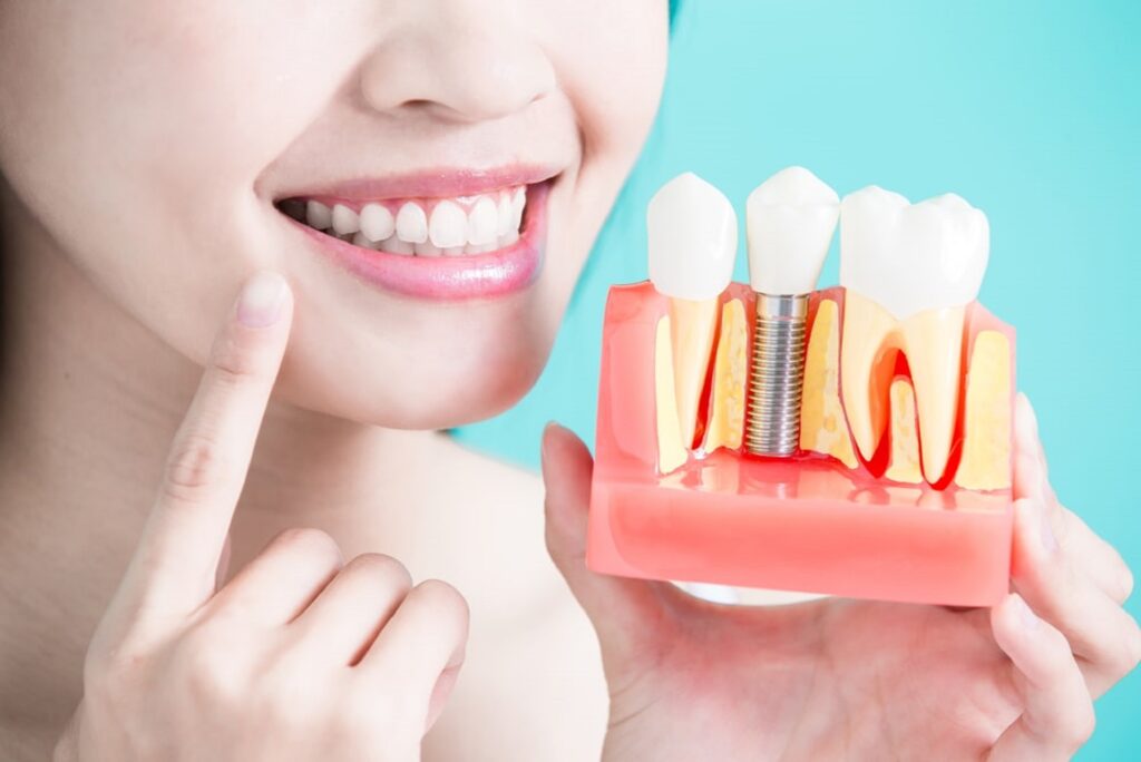 dental-implants-in-bilaspur