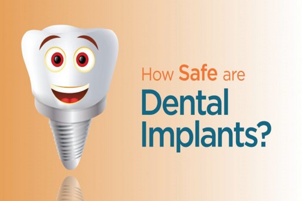 how-safe-are-dental-implants-in-bilaspur