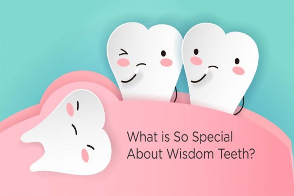 what-is-special-about-wisdom-teeth